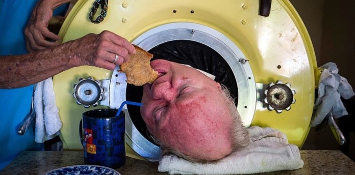 Paul Alexander, conocido como Polio Paul, murió hoy a los 78 años.